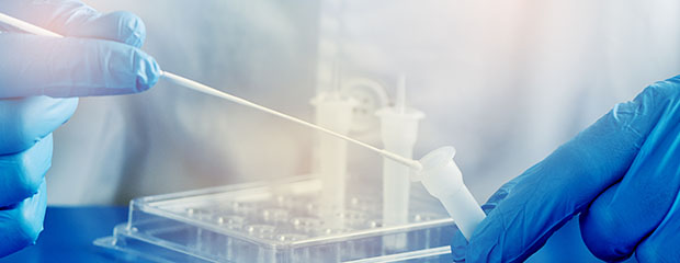 Ein Labormitarbeiter mit blauen Handschuhen führt ein Wattestäbchen in ein Plastikröhrchen